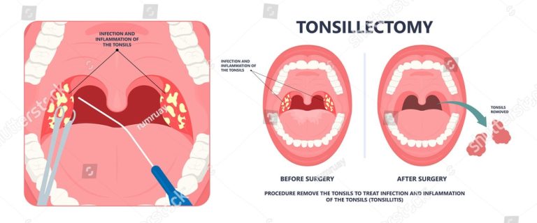 Ear, Nose, and Throat (ENT) – Kotli Healthcare Center